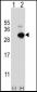 GSTO1 Antibody (Center)
